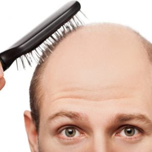 Hair Loss