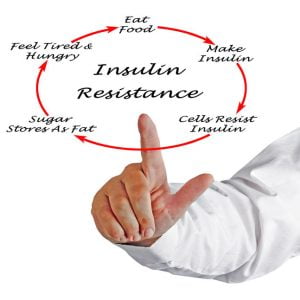Insulin Resistance